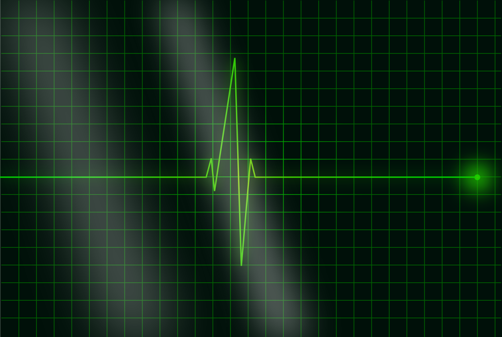 Top 5 Physiology Heart Rate Monitoring and Exercise Labs You Need to Know About