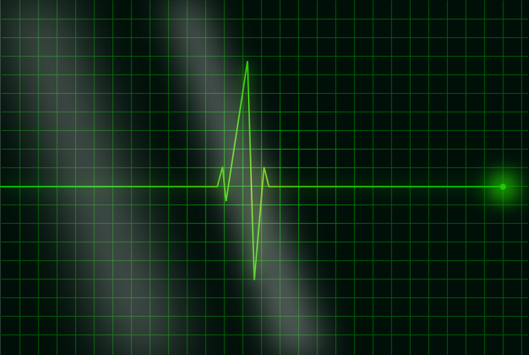 Top 5 Physiology Heart Rate Monitoring and Exercise Labs You Need to Know About